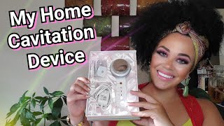 Home Laser Lipo  Ultrasound Cavitation Device Review Melts Fat [upl. by Airdnas]