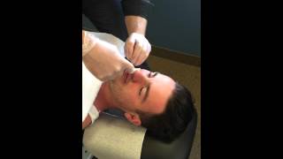 Nasal Specific Treatment  Procedure  Chiropractic Adjustment [upl. by Auj]