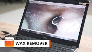 Ear wax removal tool with a microscope camera [upl. by Adnamahs]