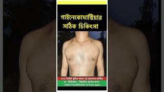 Gynecomastia Surgery Result  Best Gynecomastia Result in Bangladesh [upl. by Sadowski]