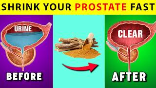 Doctors Don’t Want You to Know About These ProstateShrinking Herbs  Herbs to Shrink Prostate [upl. by Eisseb]