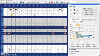 Charting Furcations and Mobility in Dentrix [upl. by Kaila508]