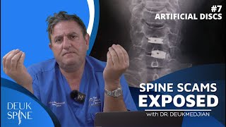 Artificial Disc Replacement Complications Ep7 Spine Scams [upl. by Jeanna785]