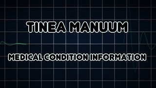 Tinea manuum Medical Condition [upl. by Ahsinrats96]