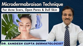 Microdermabrasion Technique for acne scars Open pores and dull skin  Treatment by Dermatologist [upl. by Haroldson881]