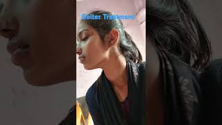 Goiter Homeopathc Treatment [upl. by Arley]