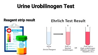 Ehrlich Aldehyde test  Test for detection of Urobilinogen in urine [upl. by Tnilc]