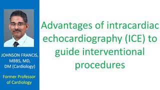 Advantages of intracardiac echocardiography to guide interventional procedures [upl. by Francis271]