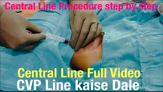 Central or Femoral Line Procedure Step By StepCVP LINECENTRALLINECENTRAL VENOUSCATHETER INSERTION [upl. by Aika453]