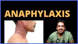 Anaphylaxis Causes Clinical features Management [upl. by Zeret711]