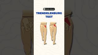 Understanding the Trendelenburg Test A key assessment for hip stability amp gluteal muscle function [upl. by Jameson781]