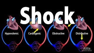 Shock Pathology of Different Types Animation [upl. by Chancey]