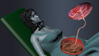 Fertilization Development of Placenta Labor and Delivery 3D Animation [upl. by Nyleikcaj]