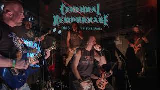 Cerebral Hemorrhage filmed by NYC Metal Scene on Comatose Music [upl. by Ahsoym]