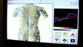 METATRON NONLINEAR BODY SCANNING TECHNOLOGY [upl. by Cassaundra]