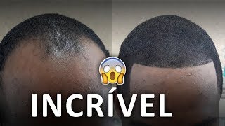 MAQUIAGEM CAPILAR INCRÍVEL NA BARBEARIA 😱 [upl. by Byron507]