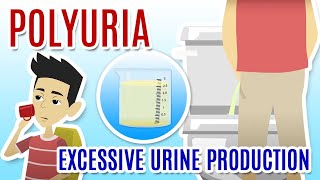 EXCESSIVE URINE PRODUCTION  Causes and Treatments of POLYURIA [upl. by Anitsirhcairam876]