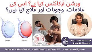 Dr C Suvarchala  Ziva Fertility ورشن آرکائٹس کیا ہے؟ اس کی علامات، وجوہات اور علاج کیا ہیں؟ [upl. by Slaughter]