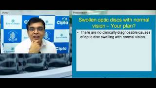 LiveWebinar  Approach to Disc Edema and Disc Atrophy   Dr Navin Jaykumar [upl. by Aerdno]