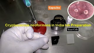 India Ink Preparation Procedure and observation of Crpytococcus neoformans capsules in CSF [upl. by Sanford]