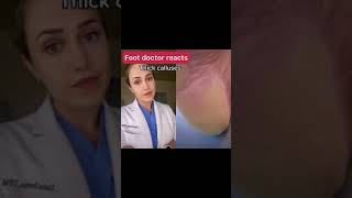 Doctor reacts painfully HUGE foot callus [upl. by Iba]