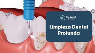 Restablece tu Salud Oral con una Limpieza Dental Profunda  The Dental District [upl. by Nicolle]