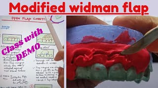 Demo explanation to understand the concept of modified widman flap easily [upl. by Skurnik]