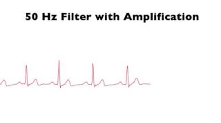 ECG 50 Hz Filter Demo 2 [upl. by Ahseen]