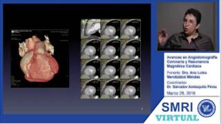 Avances en Angiotomografía coronaria y resonancia magnética cardiaca [upl. by Goddard]