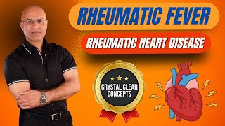 Rheumatic Fever Pathophysiology  Rheumatic Heart Disease [upl. by Ailime865]