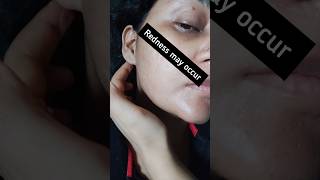 Azelaic acidaziderm10aziderm20 ytshorts skincareinhindi ytshortsindia serum clearskin [upl. by Dimond]