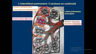 syndrome interstitiel en détails 01 [upl. by Enelhtac726]