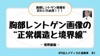 胸部レントゲン画像の正常構造と境界線 ー 境界線編 ー [upl. by Emerej154]