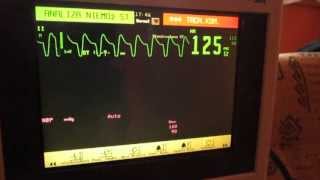 EKG Monitor [upl. by Goldshell]