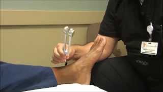 Neurologic Examination of the Foot The 128 Hz Tuning Fork Test [upl. by Ysnil]