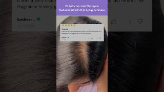 Get Rid of Dandruff using this dandruffshampoo ketoconazoleshampoo [upl. by Shaum205]