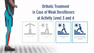 FIOR amp GENTZ  The Right Orthosis in Case of Paralysed Dorsiflexors  Activity Level 3 and 4 [upl. by Attej]