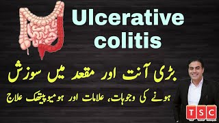 Ulcerative colitis । Colitis  diarrhea । stomach pain।blood mucus by Adeel mansoor  Urdu  Hindi [upl. by Davon]