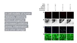 HDAC3 A new target in treating diabetic vasculopathy [upl. by Tammi629]