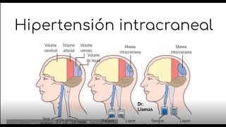 Aumento de la PIC  Edema cerebral Hidrocefalia Hernias cerebrales  FISIOPATOLOGÍA [upl. by Aroon473]