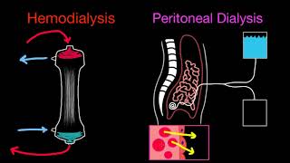 Basics of Dialysis and Modalities [upl. by Annaoy]