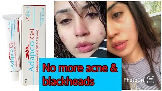 How to use Tretinoin  Skincare products Layer step by step skincare tretinoin [upl. by Yolanthe]