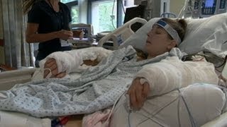 Quadruple Amputee Undergoes Hand Transplant Surgery [upl. by Nnaegroeg]