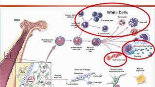 Aplastic Anemia Approach on Diagnosis and Treatment Options 2018 [upl. by Whitehurst]