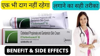 clobetamil g cream review clobetamil g clobetamil g cream ke fayde aur side effects clobetamil g [upl. by Kenaz821]