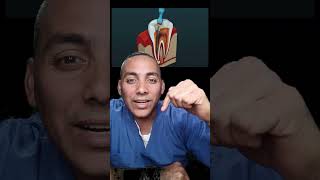 ¡Necesitas una endodoncia [upl. by Noraj331]