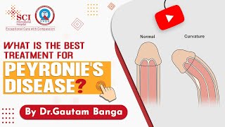 What is Peyronies Disease and Best Treatment For You  BY Dr Gautam Banga  SCI Hospital [upl. by Johannessen]