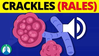 Crackles Rales  Medical Definition and Explanation [upl. by Arekat]