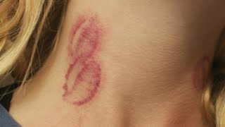 how to give someone a hickey on the neck fast tutorial [upl. by Toms618]