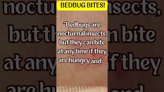 quotUnveiling the Hidden Truth Shocking Facts About Bed Bug Bites Revealedquot [upl. by Tilagram]